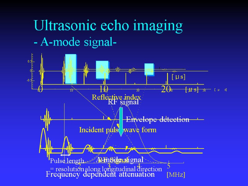 Ultrasonic echo imaging - A-mode signal- Envelope detection